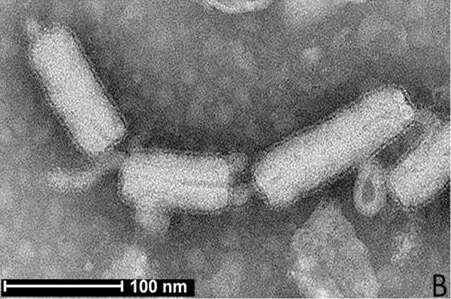 Image of rabies virus and relatives