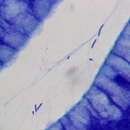 Helicobacter heilmannii resmi