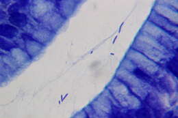 Image de Helicobacter heilmannii