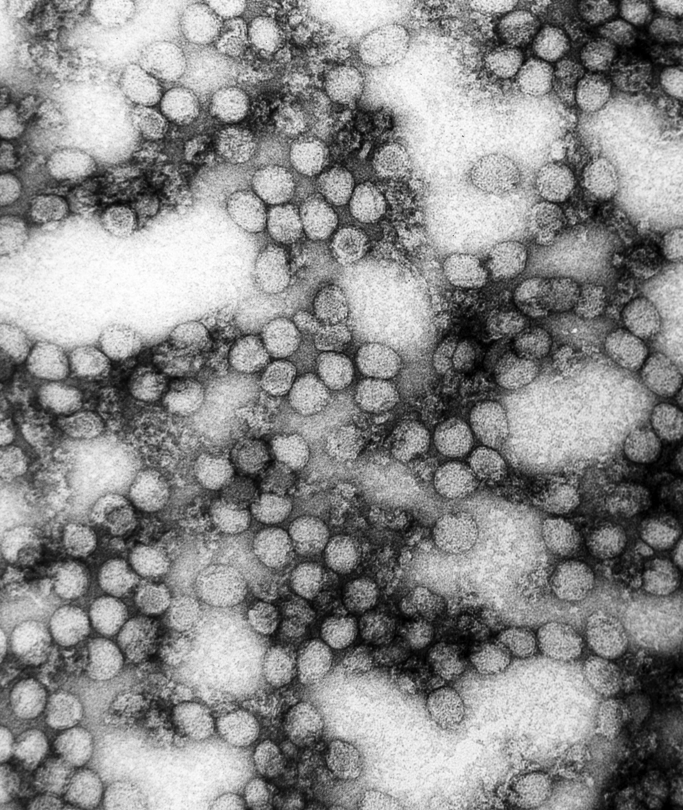 Image of Powassan virus
