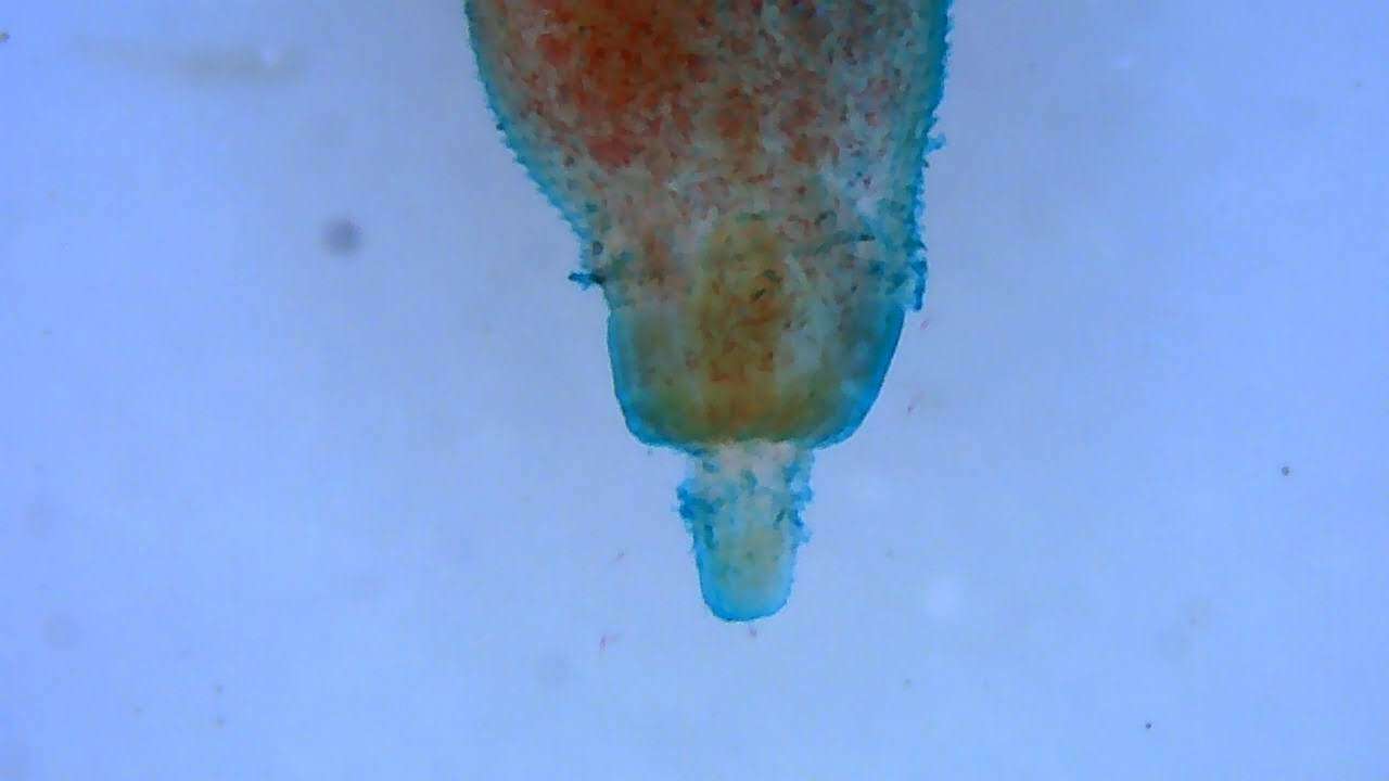 Image of Acanthocephala