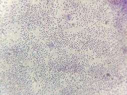 Image de Streptococcus pneumoniae