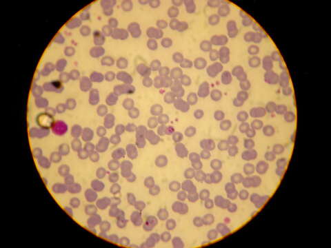 Image of Plasmodium subgen. Plasmodium