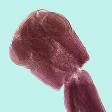 Image of Mesocestoididae