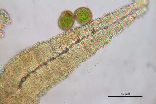 Image of orthotrichum moss