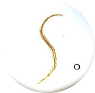 Image of Pinworm