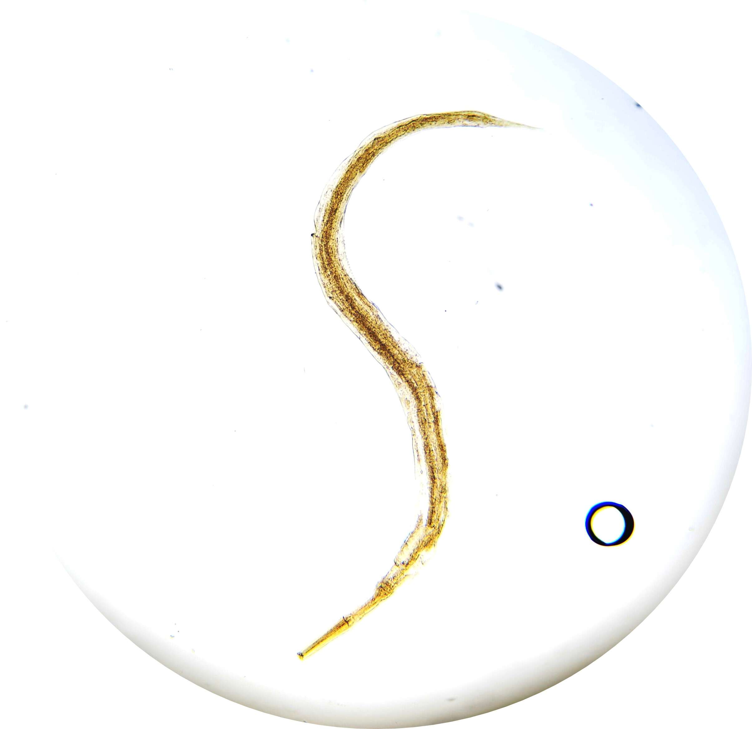 Image of Pinworm