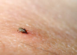 Image of Common sheep tick