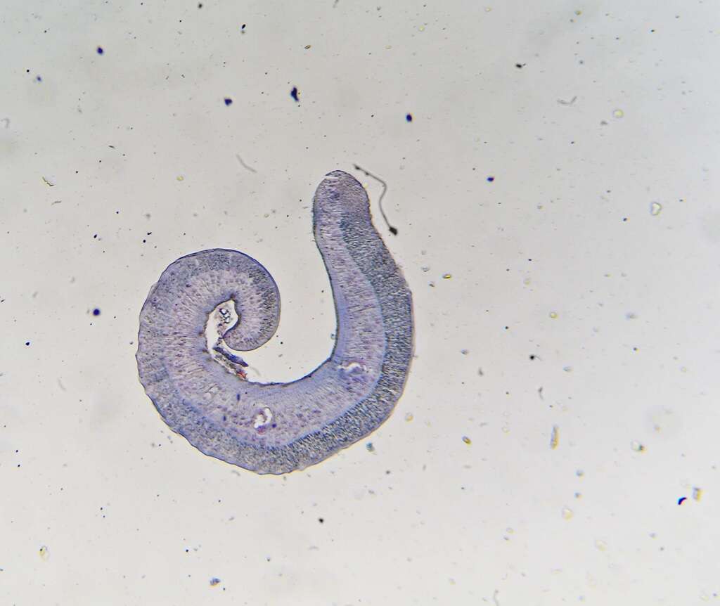 Image of Schistosoma mansoni