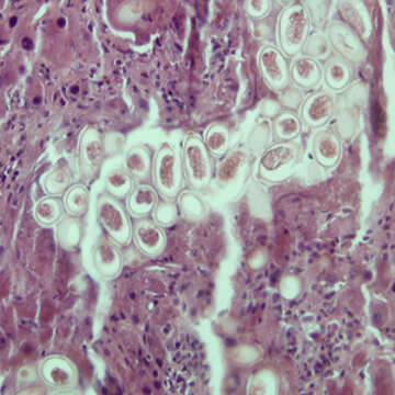 Image of <i>Capillaria hepatica</i>
