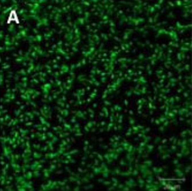 Image of Photorhabdus luminescens