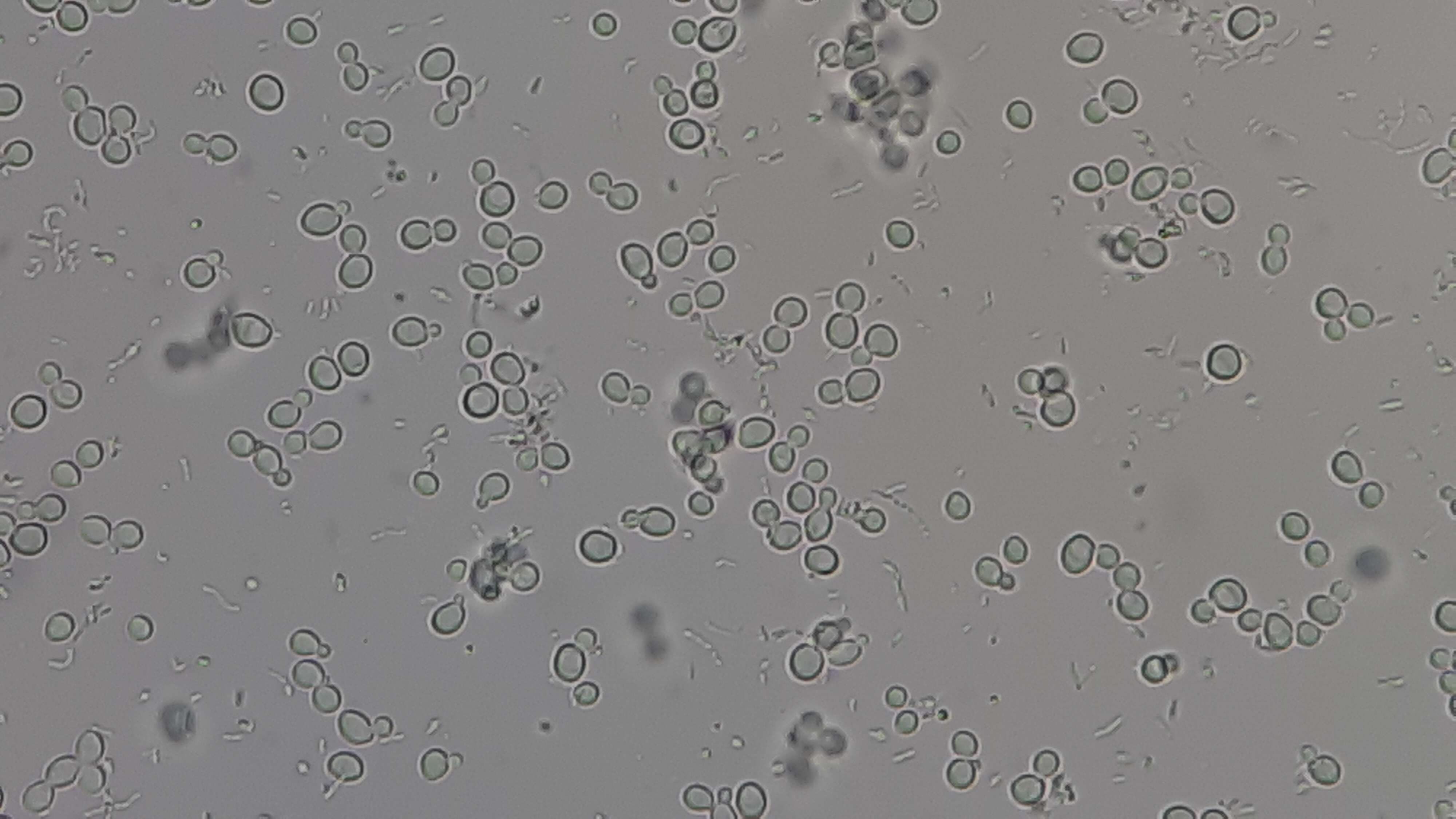 Imagem de Cryptococcus