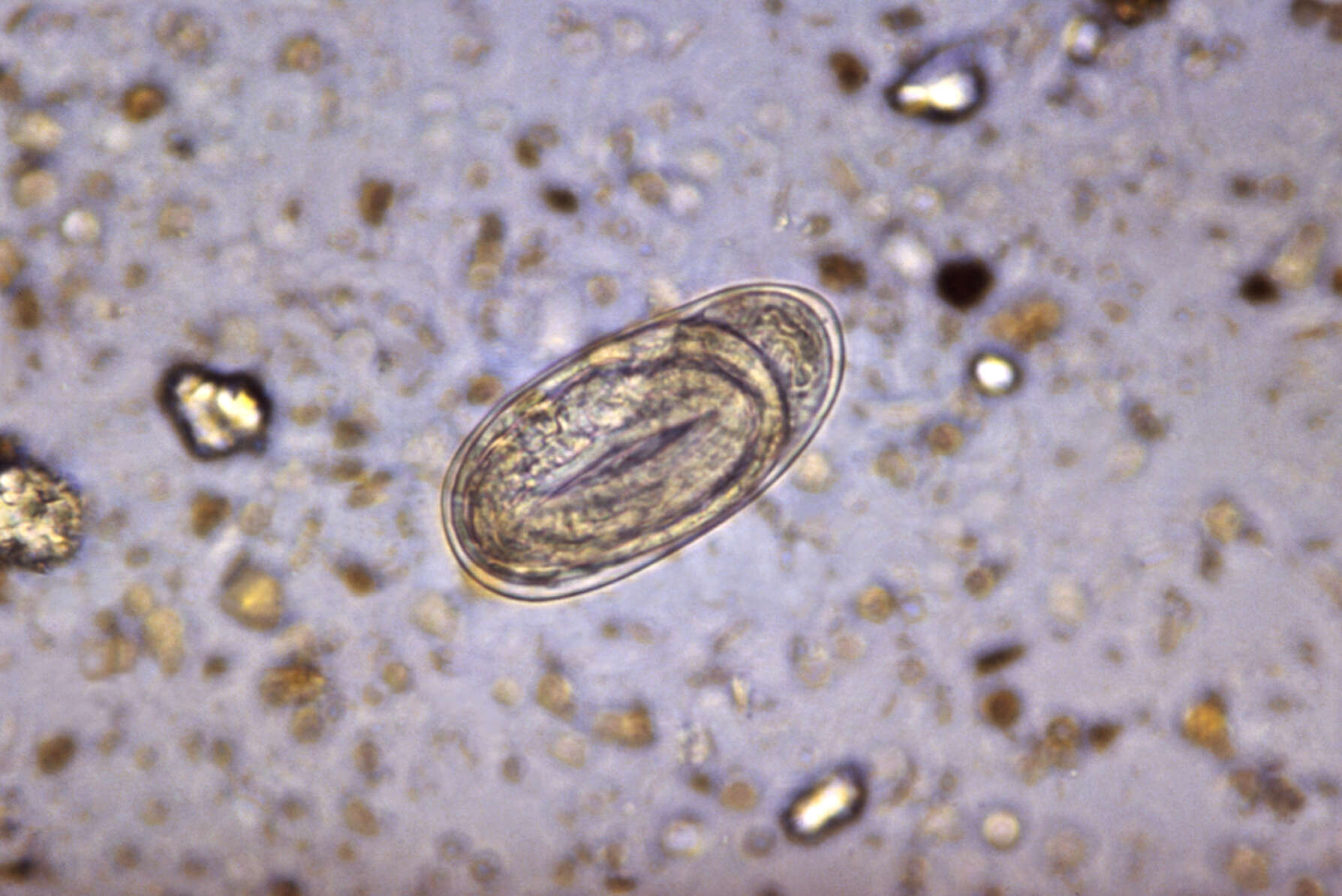 Image of Ancylostoma duodenale