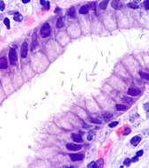 Image of Helicobacter heilmannii