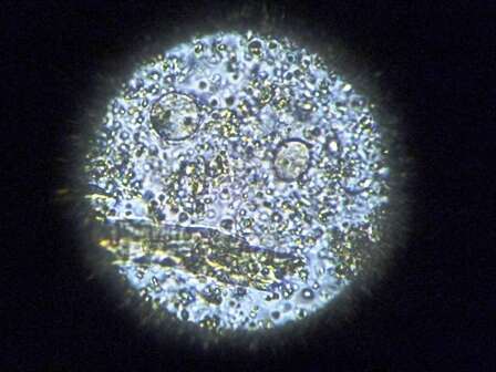 Image de Entamoeba coli