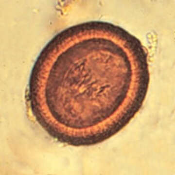 Image of Taenia solium