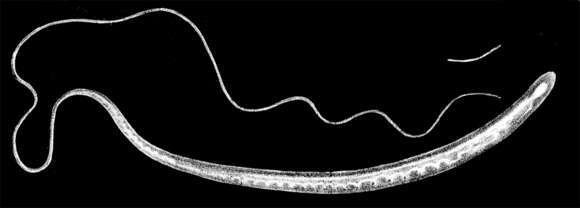 Image of Trichuris trichiura