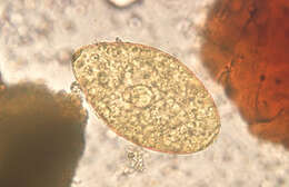Image of Echinostoma
