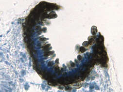 Image of lichenoconium lichen