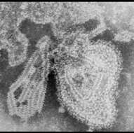 Слика од Mumps rubulavirus