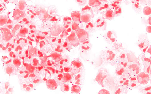 Image of Neisseria meningitidis