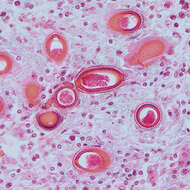 Imagem de <i>Capillaria hepatica</i>