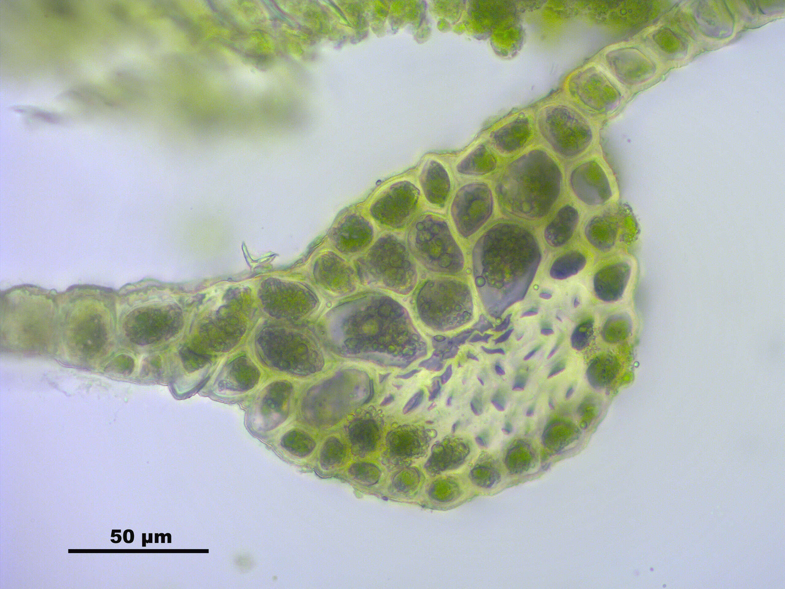 Image of pohlia moss