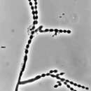 Plancia ëd Cladophialophora carrionii (Trejos) de Hoog, Kwon-Chung & McGinnis 1995