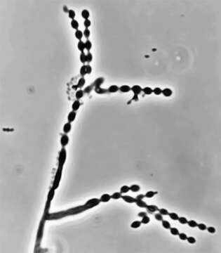 Plancia ëd Cladophialophora carrionii (Trejos) de Hoog, Kwon-Chung & McGinnis 1995