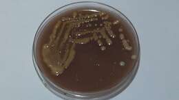 Image of Cryptococcus