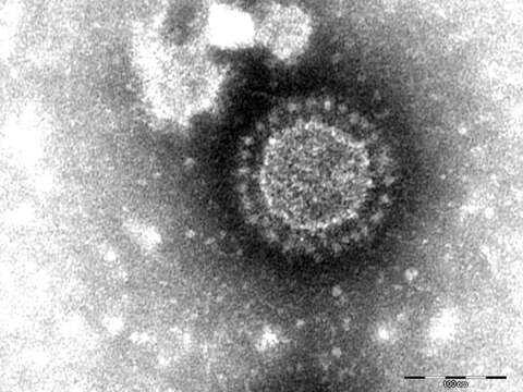 Image of Porcine epidemic diarrhea virus