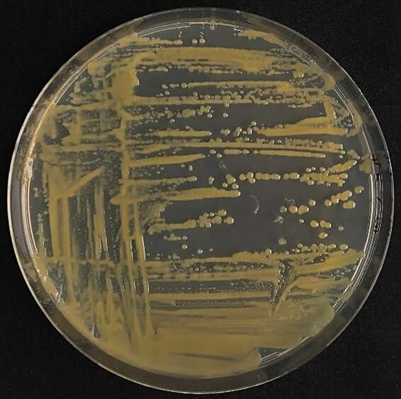 Plancia ëd Xanthomonas campestris