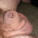 Image of Microphallus