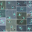 Imagem de Trypanosoma congolense