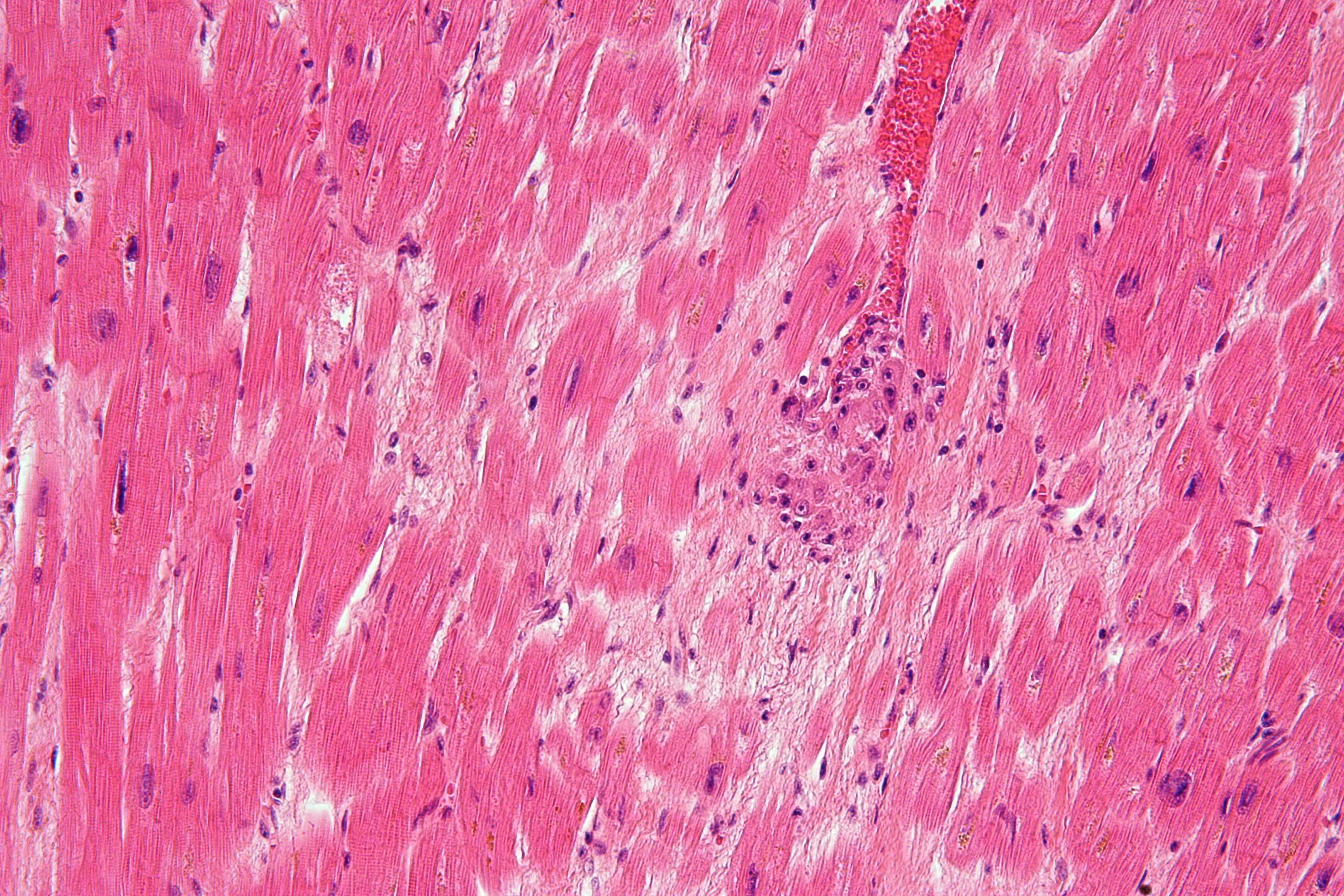 Image of Streptococcus pyogenes