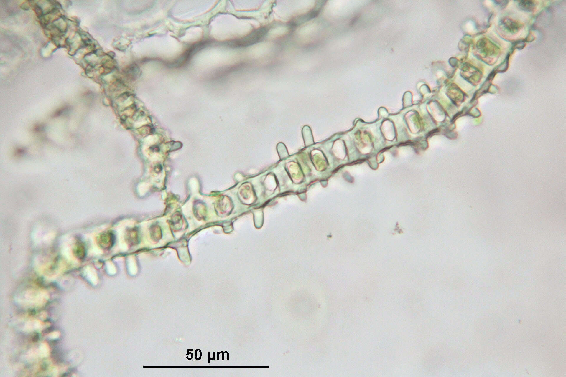 Image of Lyell's orthotrichum moss