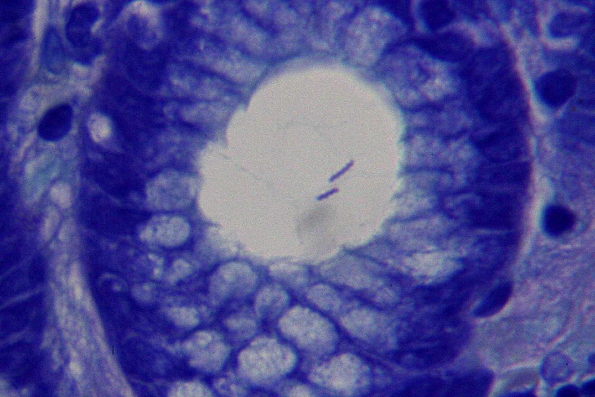 Image of Helicobacter heilmannii