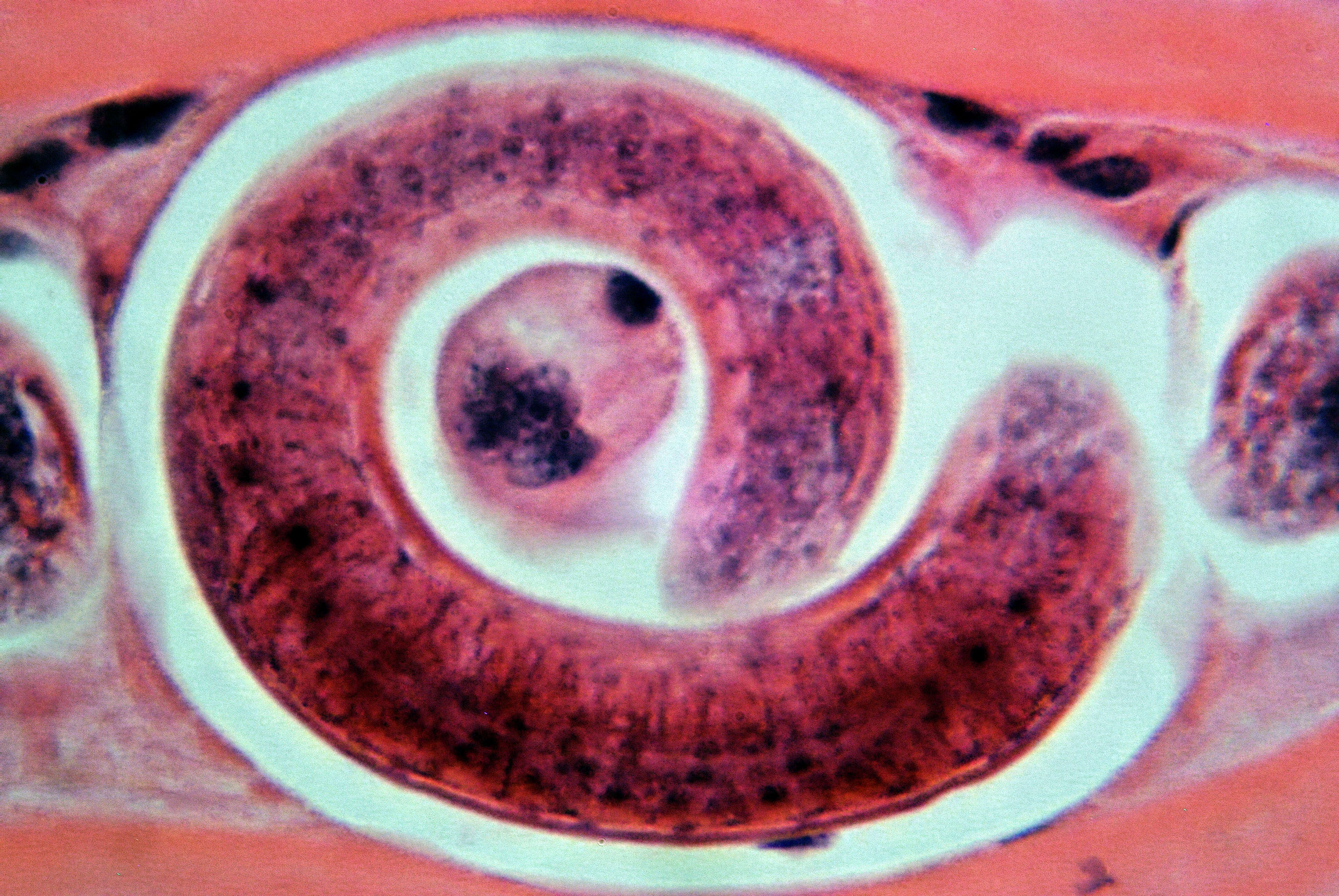 Image of Trichinelloidea