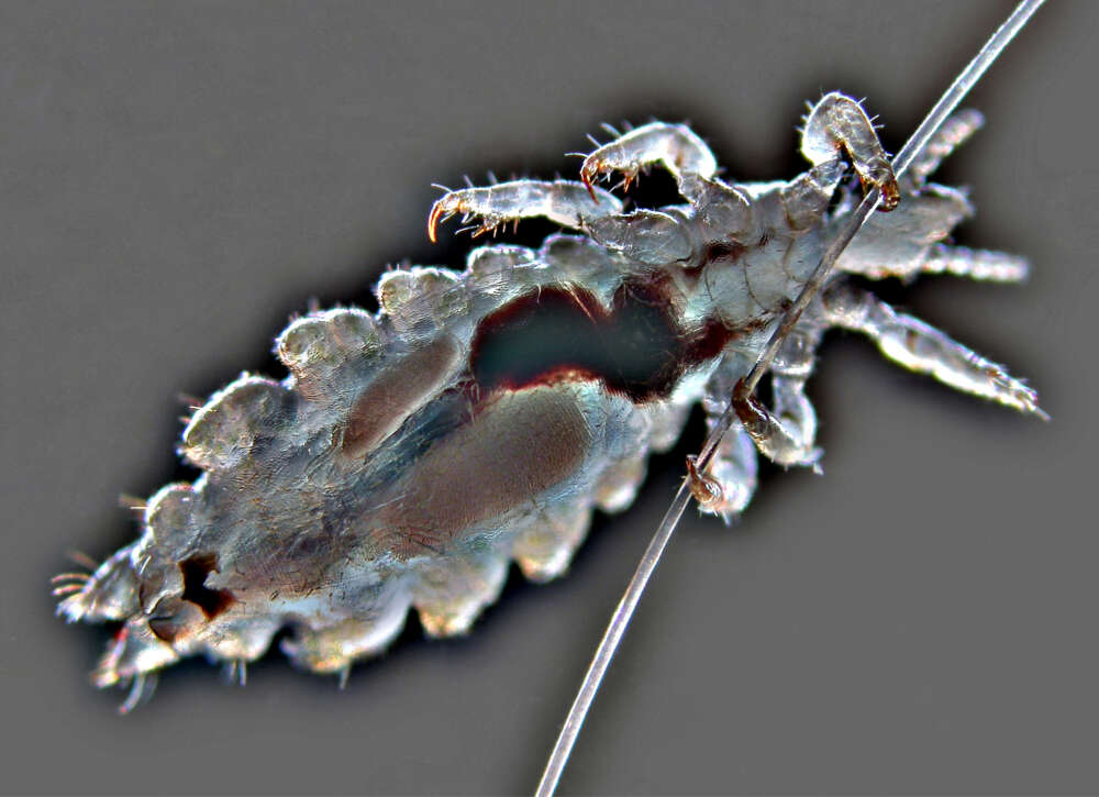 Image of head louse