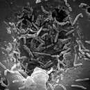 Image of Mycobacterium chelonae