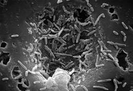 Image of Mycobacterium chelonae
