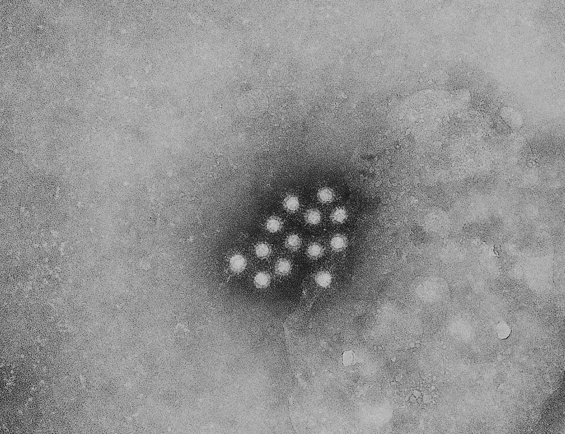 Image of Picornavirus