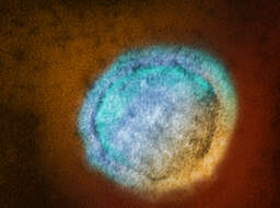 Image of Nipah virus
