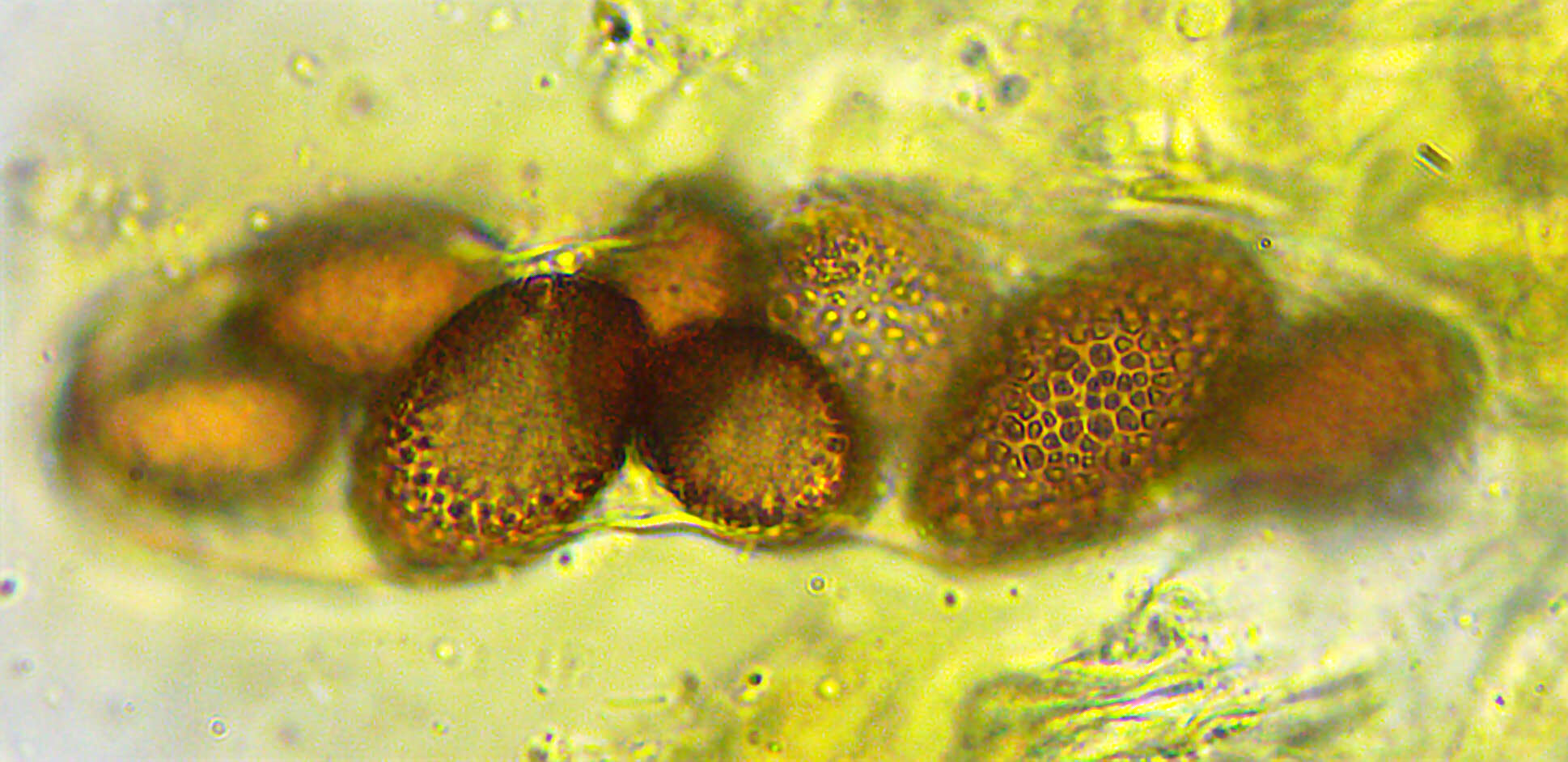 Image of Ascobolus carbonarius P. Karst. 1870