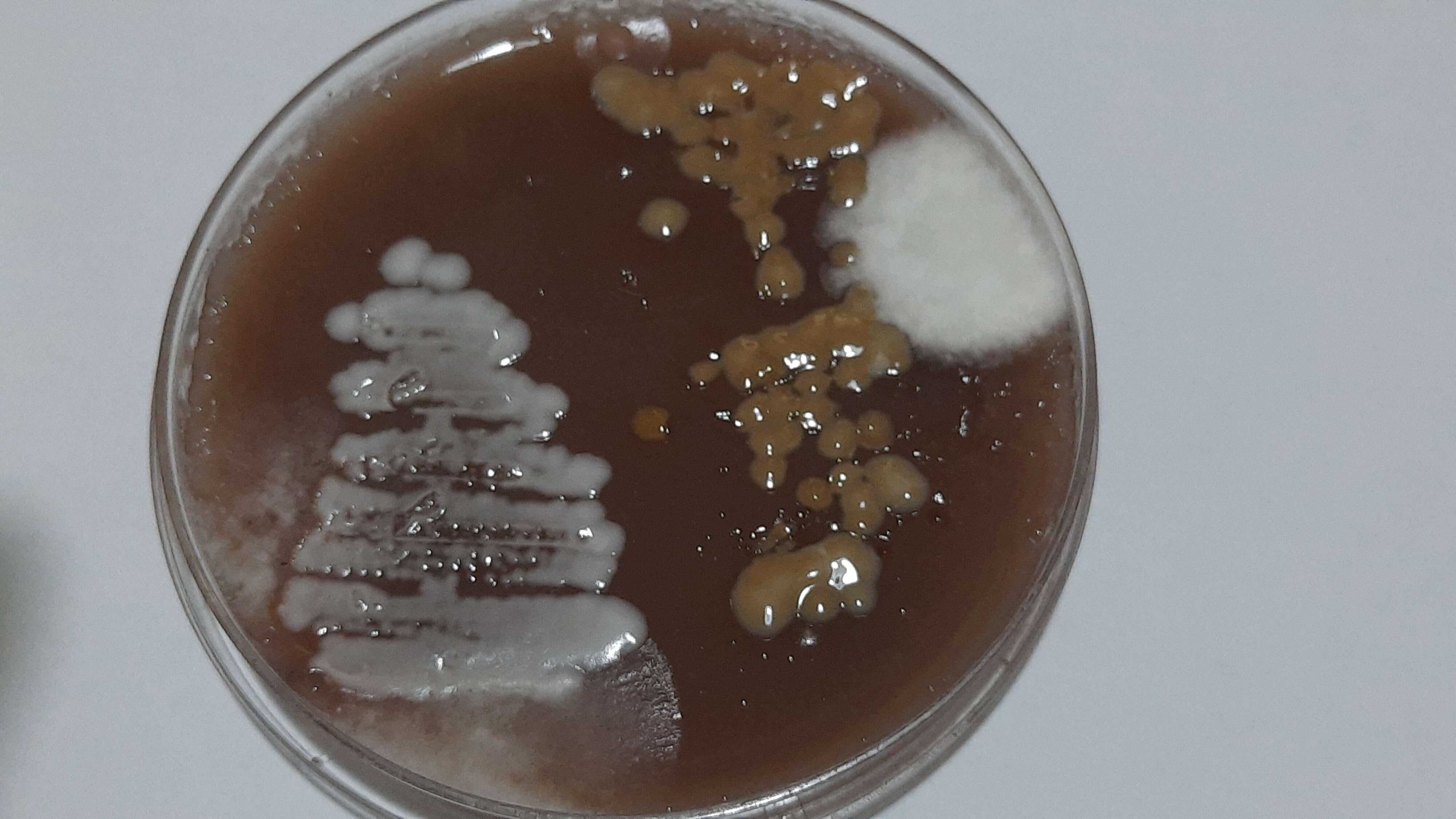 صورة unclassified Saccharomycetales