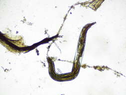 Image of Pinworm