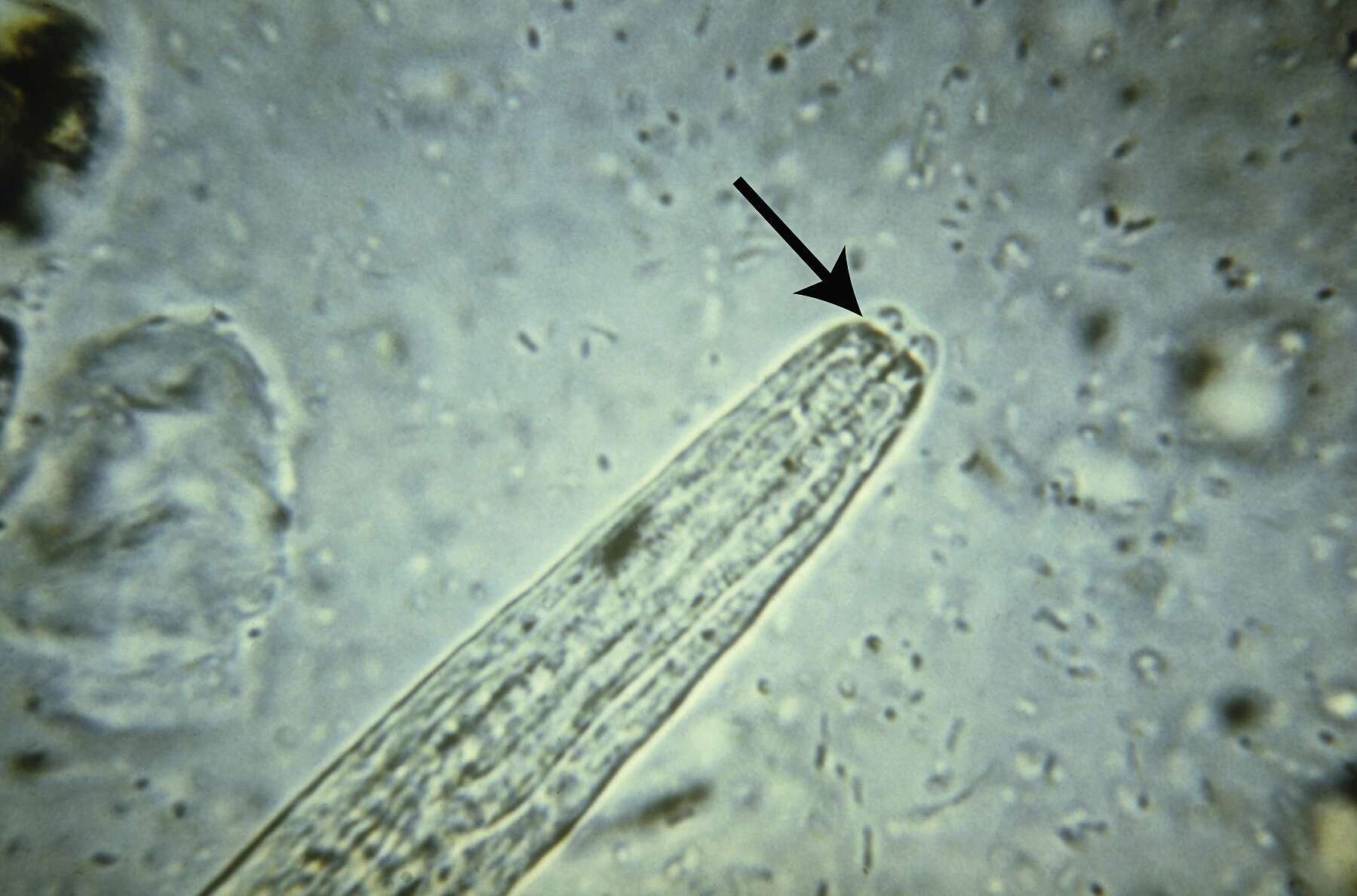 Image of Strongyloides