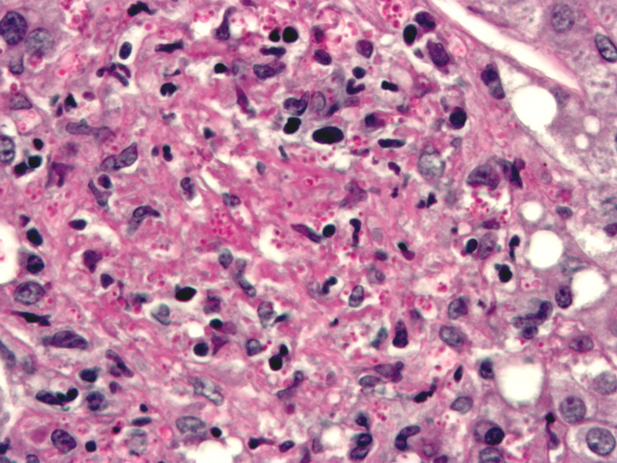 Image of Histoplasma