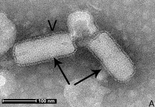 Image of rabies virus and relatives