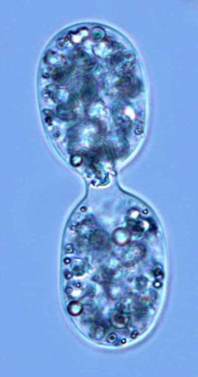 Image of Achromatium